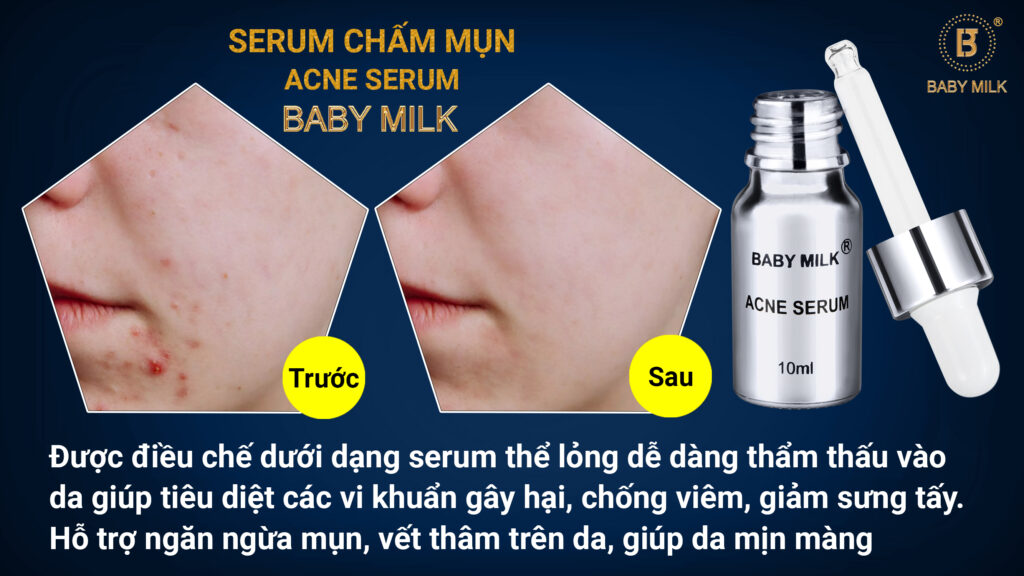 serum trị mụn Baby Milk